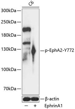EphA2 (Phospho-Y772) antibody