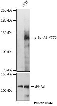 EphA3 (Phospho-Y779) antibody