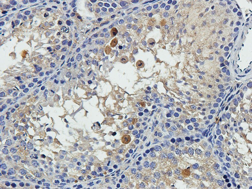 EPHA4 antibody