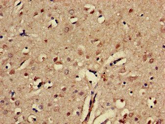 EPHA5 Antibody