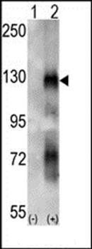 EphA6 antibody