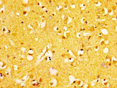 EPHA6 Antibody