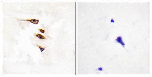 EPHA6 antibody