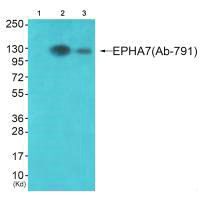 EPHA7 (Ab-791) Antibody