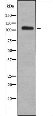 EPHB1/2/3/4 (Phospho-Tyr600/602/614/596) antibody