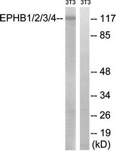 EPHB1/2/3/4 antibody