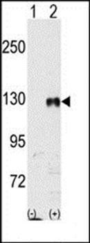 EphB1 antibody