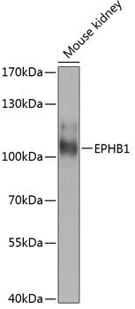 EPHB1 antibody