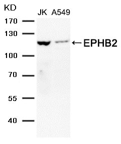 EPHB2 antibody