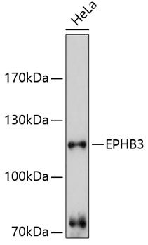 EPHB3 antibody