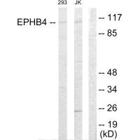 EPHB4 antibody