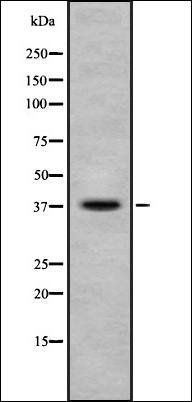 Ephrin B1/B2/B3 (Phospho-Tyr324) antibody