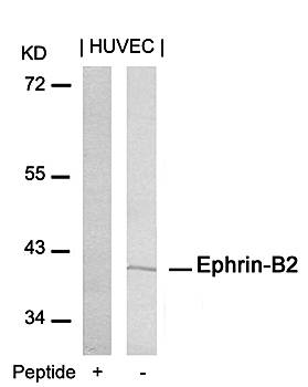 Ephrin-B2 (Ab-316) Antibody