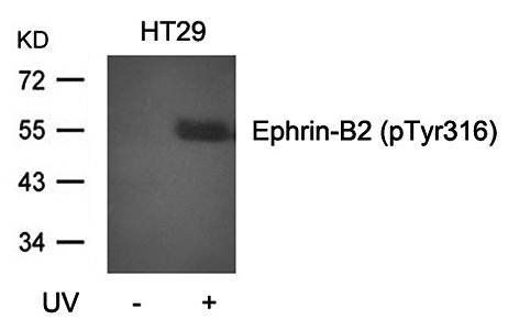 Ephrin-B2 (Phospho-Tyr316) Antibody