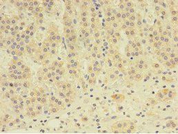 EPHX2 Antibody