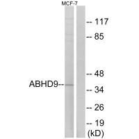 EPHX3 antibody