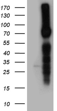 epithelial Sodium Channel alpha (SCNN1A) antibody