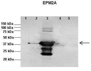 EPM2A antibody