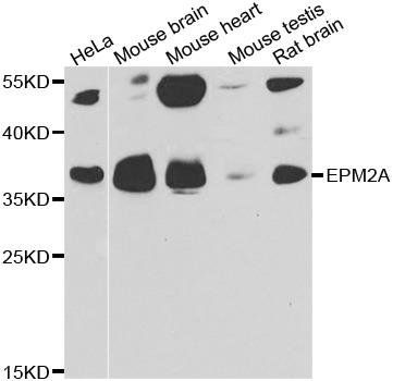 EPM2A antibody