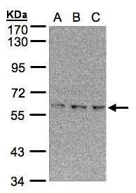 EPM2AIP1 antibody [N1], N-term