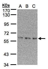 EPM2AIP1 antibody