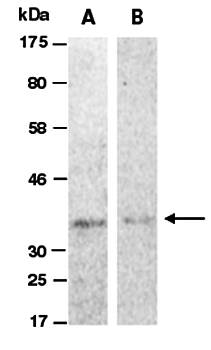EPO (vPairTM) Antibodies
