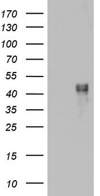 Epoxide hydrolase (EPHX1) antibody