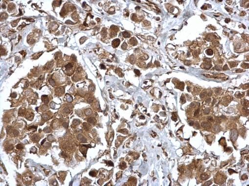 EPS8 antibody [C3], C-term
