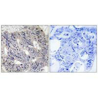 EPS8L1 Antibody