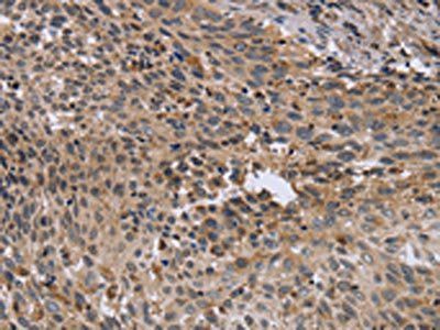 EPSTI1 Antibody