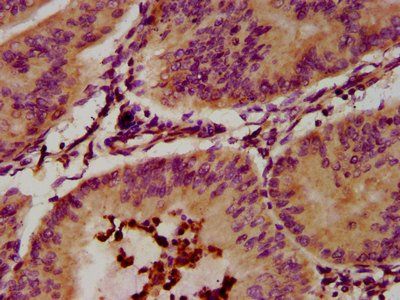 EPX Antibody