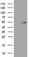 ER81 (ETV1) antibody