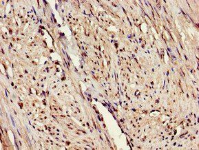 ERAP1 Antibody