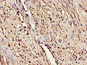 ERAP1 antibody