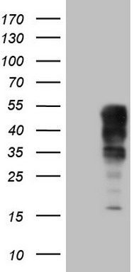 ErbB 3 (ERBB3) antibody