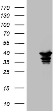 ErbB 3 (ERBB3) antibody