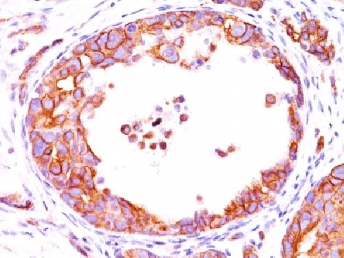 ERBB2 Antibody