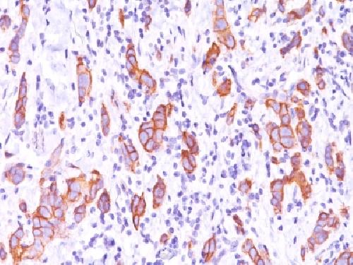 ERBB2 Antibody