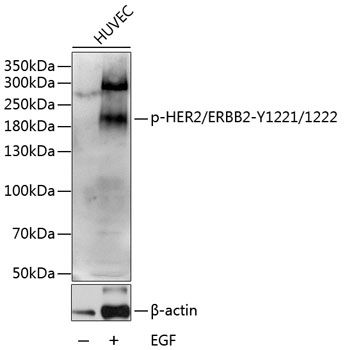 ERBB2 (Phospho-Y1221/1222) antibody