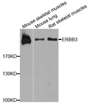 ERBB3 antibody