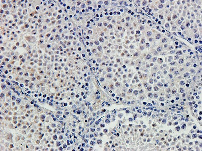 ERBB3 Rabbit Polyclonal Antibody