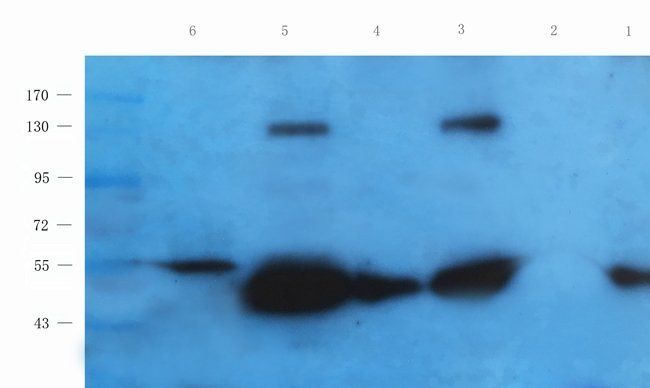 ERBB3 Rabbit Polyclonal Antibody