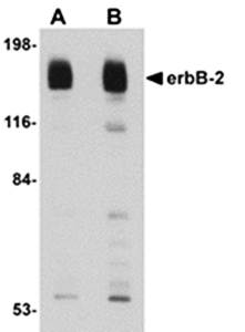 erbB-2 Antibody