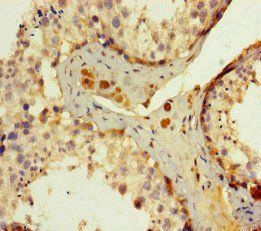 ERCC1 Antibody
