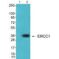 ERCC1 Antibody