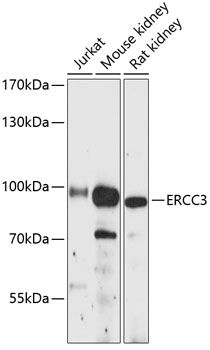 ERCC3 antibody