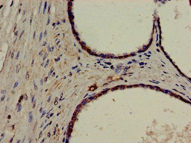 ERCC4 antibody