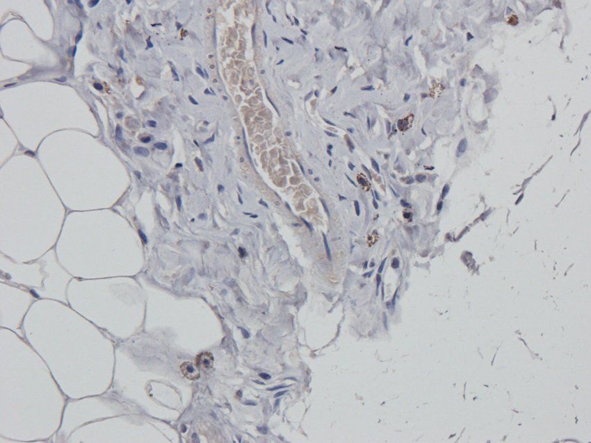 ERCC5 antibody