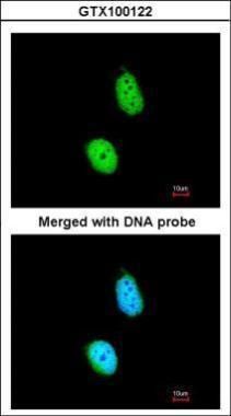 ERCC8 antibody