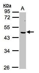ERCC8 Rabbit Polyclonal Antibody
